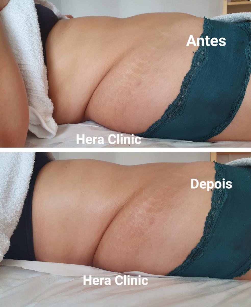 a707824d-1cd7-476b-83ed-3ea17cd72ec2