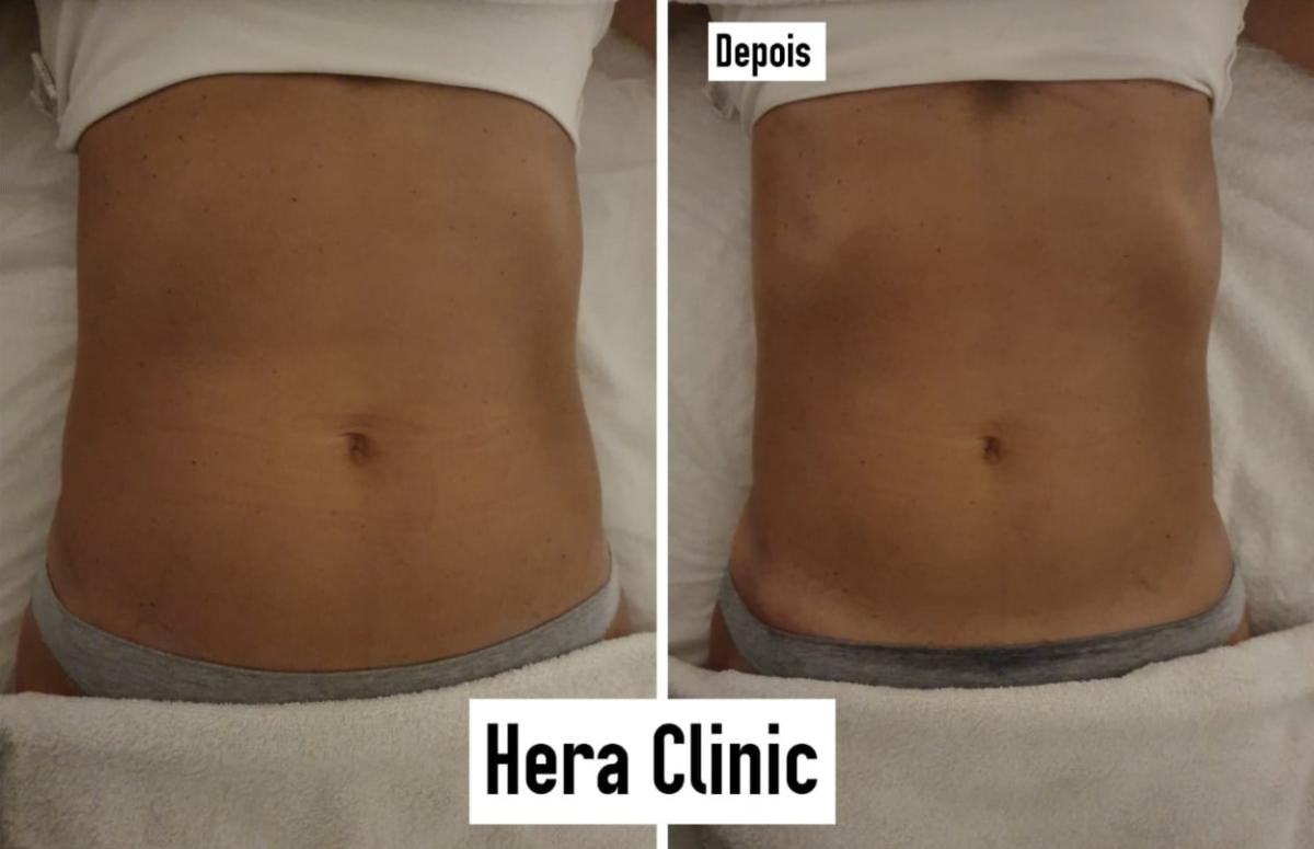 d37d6d57-e036-4717-a732-d6ef468cd5c5